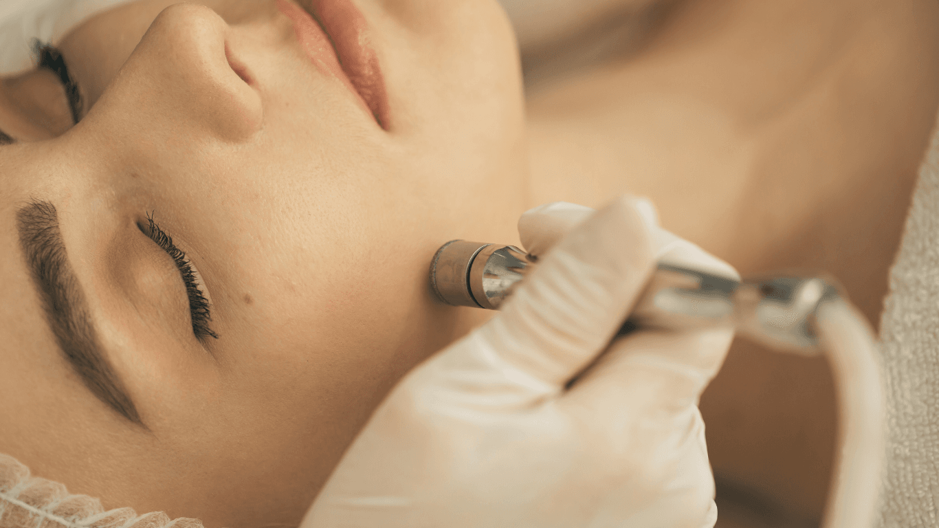 Microdermabrasion